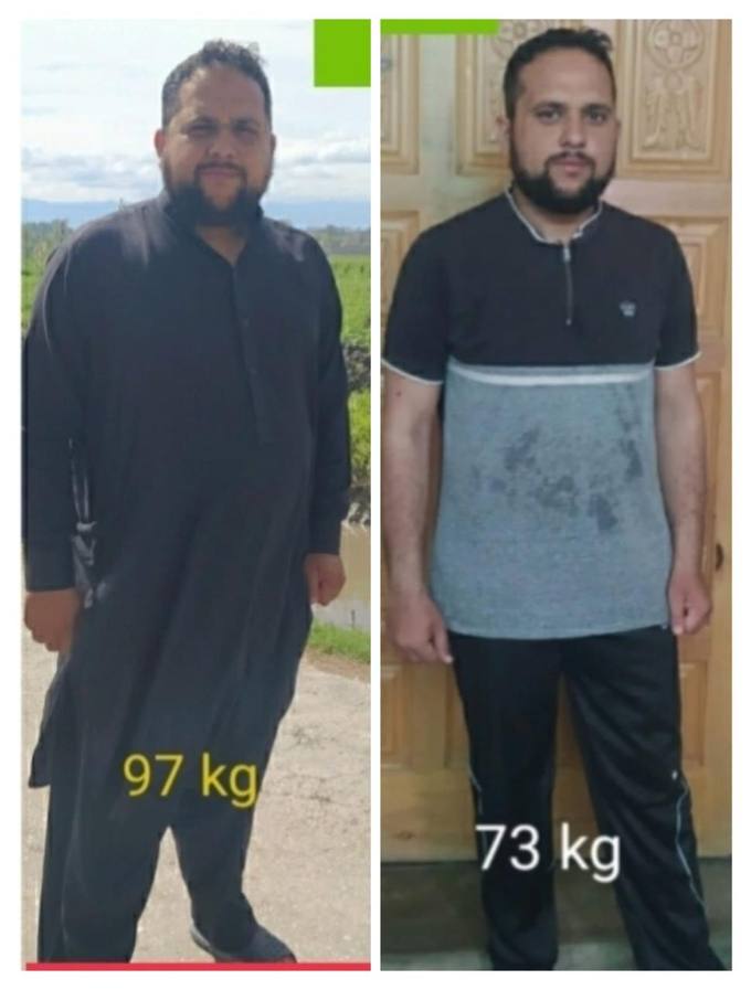 Client before and after photo