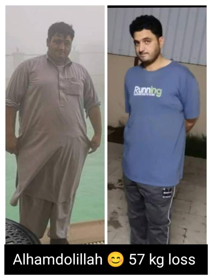 Client before and after photo